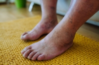 Proactive Diabetic Foot Care