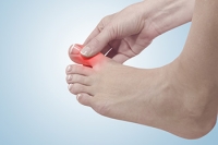 How to Manage Gout